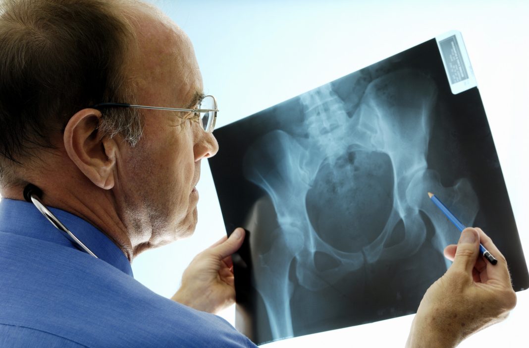 the best orthopedic surgeon for knee replacement in Mumbai