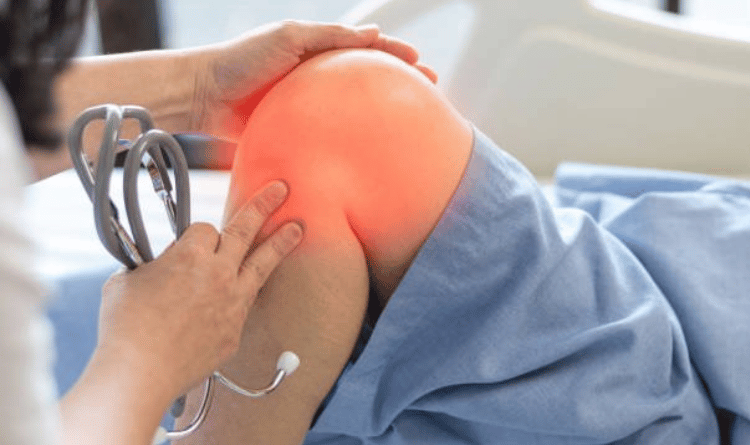 Expert ACL Surgery in Goa: Trusted Care for Knee Injuries