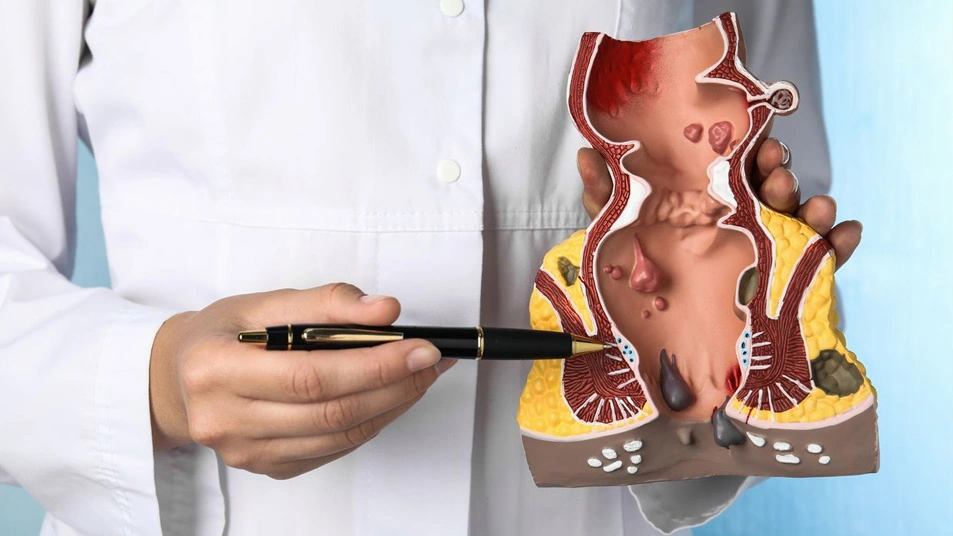 Why Curasia Hospital is the Best Piles Clinic in Zirakpur for Safe and Advanced Treatment