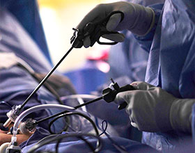 Laser Piles Surgery in Mohali: Safe, Effective & Pain-Free Treatment