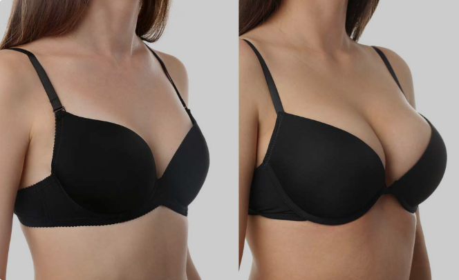 Best Breast Augmentation Surgeon in India – Redefining Beauty with Precision