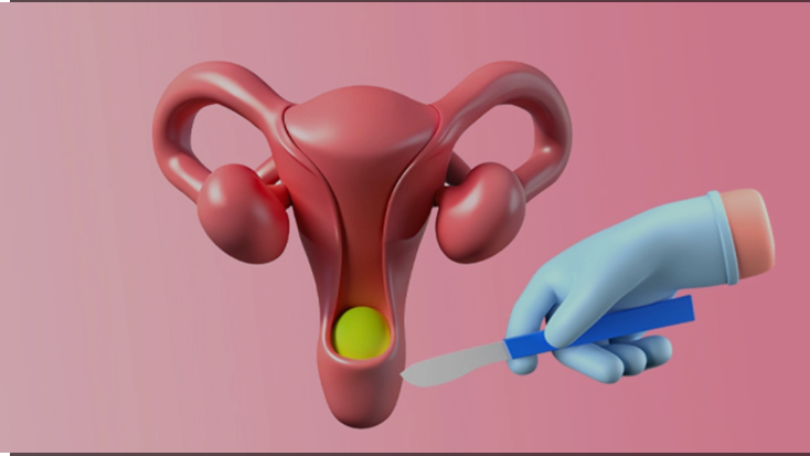 Uterus Removal Experts in Mohali Safe and Advanced Surgical Care