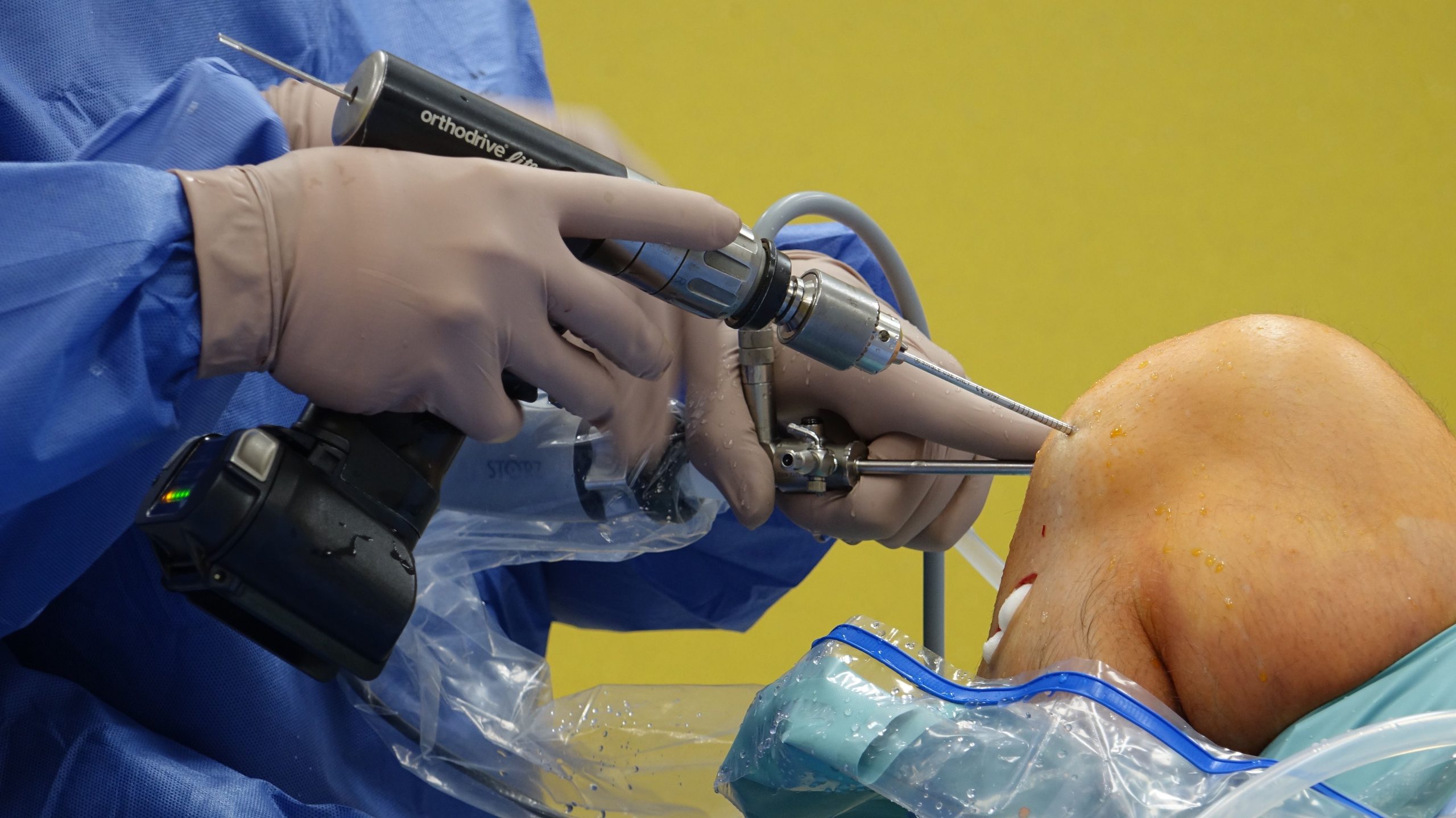 Best Knee Replacement Surgeon in Mumbai