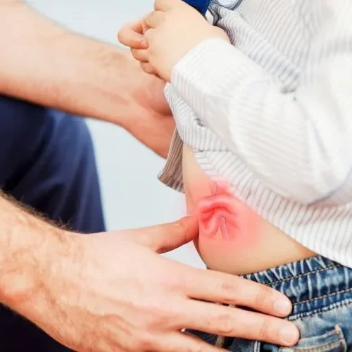 hernia surgery in Chandigarh