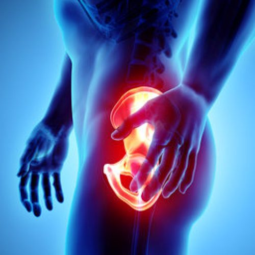 Activities after Total Hip Replacement- Do’s and Don’ts