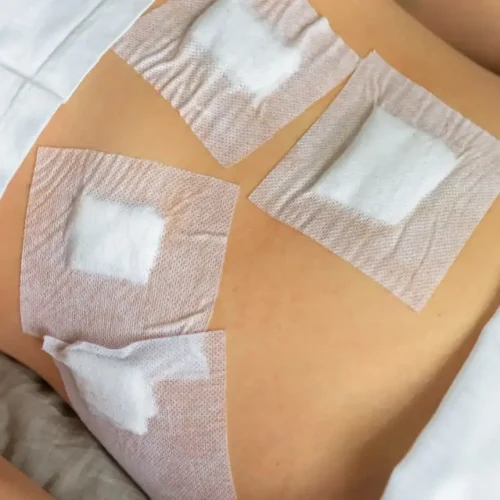 Experience Minimally Invasive Treatment at the Best Gallbladder Surgery in Zirakpur