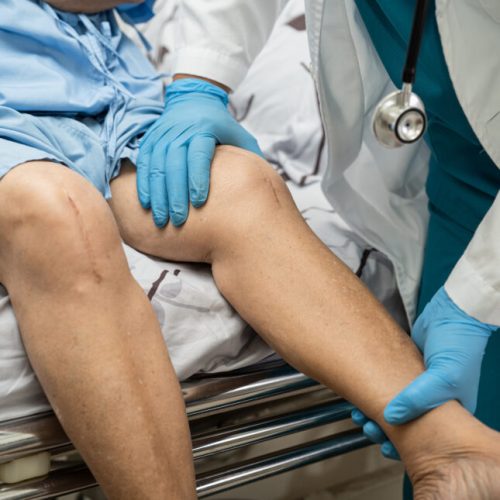 Preparing for Knee Replacement Surgery in Jaipur: Essential Tips