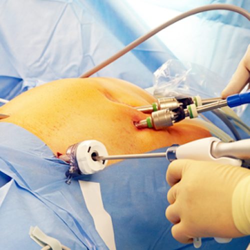 Trusted Uterus Removal Expert in Mohali: Safe & Advanced Gynecological Care