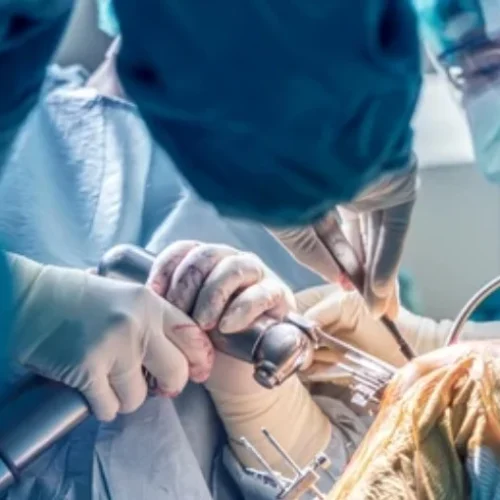 knee replacement surgery in Jaipur