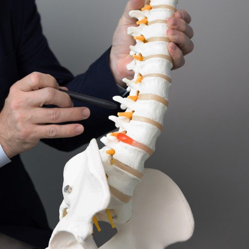 In Search of Relief: Your Guide to Spine Surgeons in Chandigarh