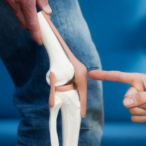 Knee Replacement Surgery in Goa