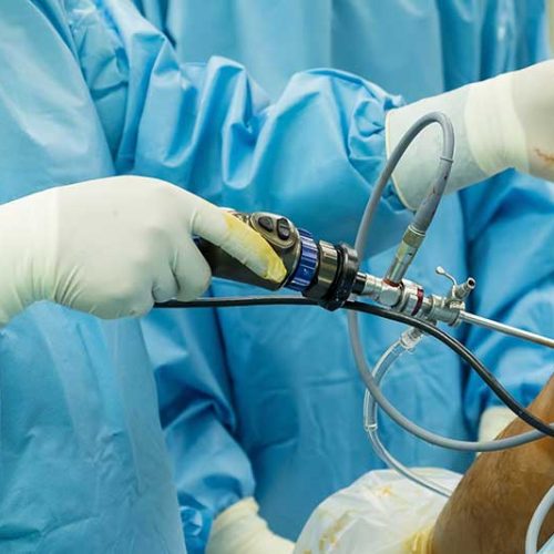 Advanced Robotic Knee Replacement Surgery in Mumbai: Precision Care for Faster Recovery