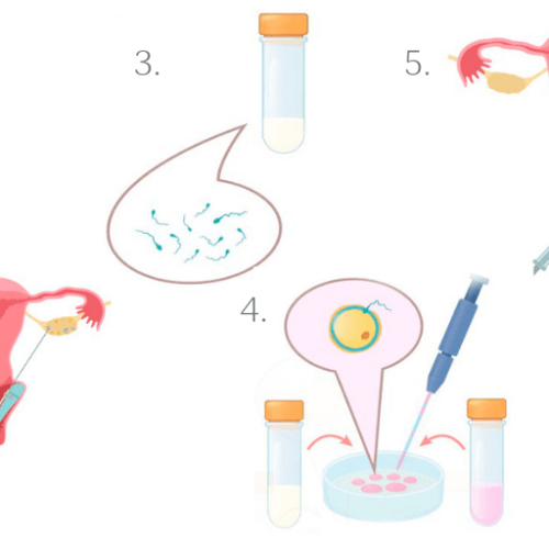 IVF center in Kandivali