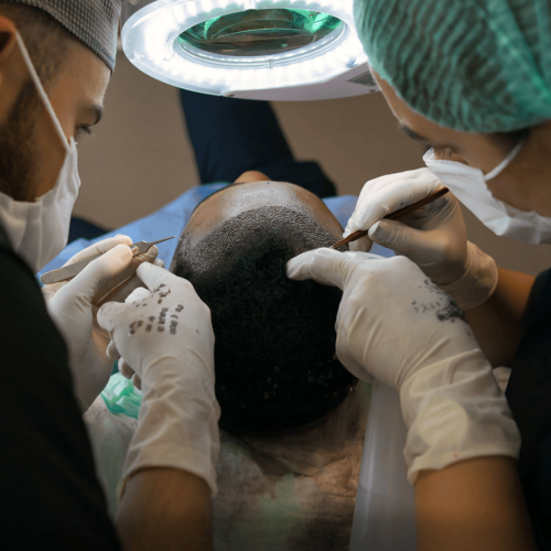best hair transplant in Chandigarh cost