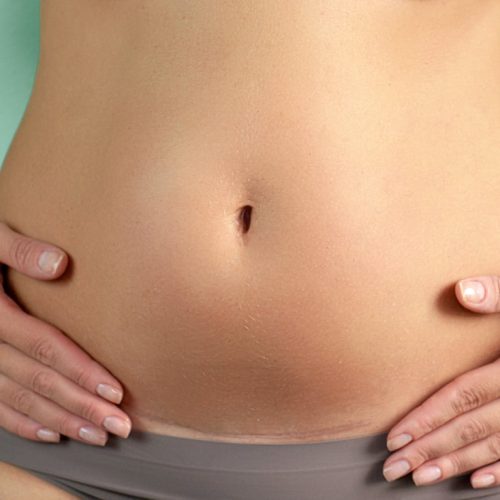 Why These Gynaecologists are the Best Choice for Caesarean Deliveries in Panchkula