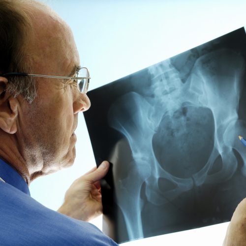 Saying Goodbye to Knee Pain: Your Expert Guide to the Best Surgeon in Mumbai