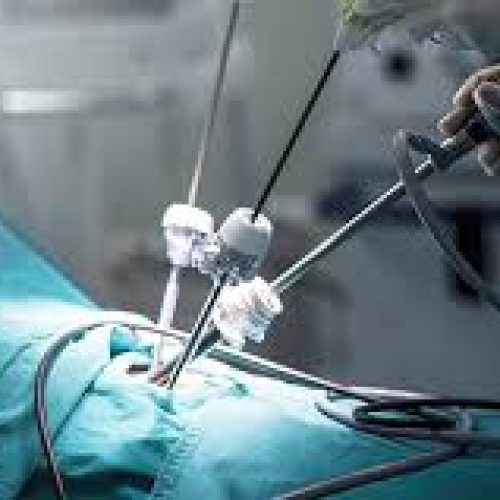 Laparoscopic Surgeon In Kandivali