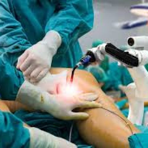 Advanced Robotic Knee Surgery in Mumbai: The Future of Joint Care