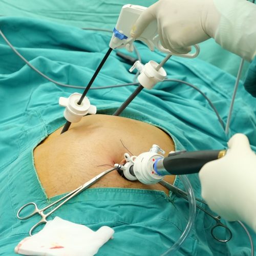 Best Gallbladder Surgery in Zirakpur – Advanced Care for a Healthy Recovery