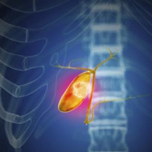 Revolutionizing Healthcare: Gallbladder Treatment in Chandigarh Hospitals