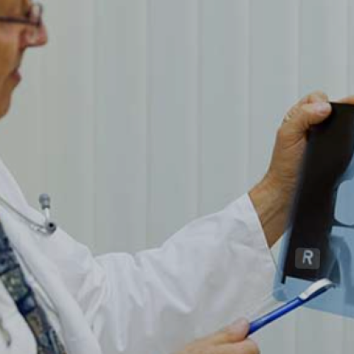 Best Knee Replacement Doctor in Mohali – Expert Care and Advanced Treatment