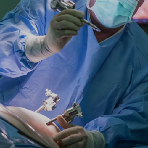 Laparoscopic Gallbladder Removal in Mohali – Precision, Safety, and Faster Recovery