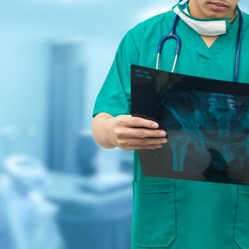 Elevate Your Knee Care: A Guide to the Best Knee Surgeon in Chandigarh