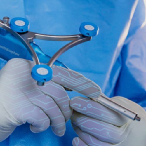 robotic knee replacement surgery in Mumbai