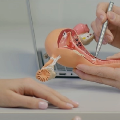 Uterus Removal Expert in Mohali