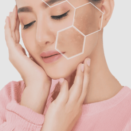 Pigmentation treatment in Mohali