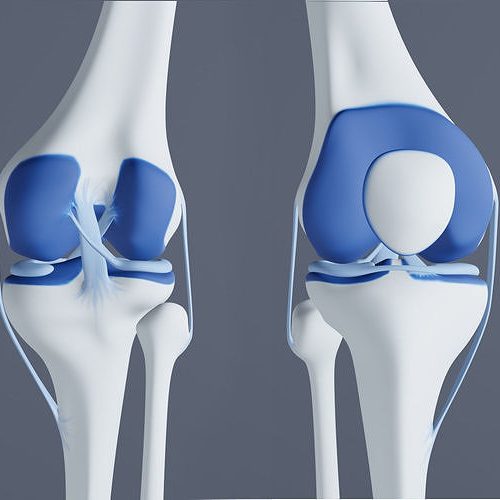 Revolutionizing Recovery: Experience FT 3D Knee Resurfacing at Healing Hospital, Delhi