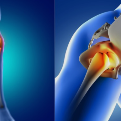 surgeon for knee replacement in Mumbai