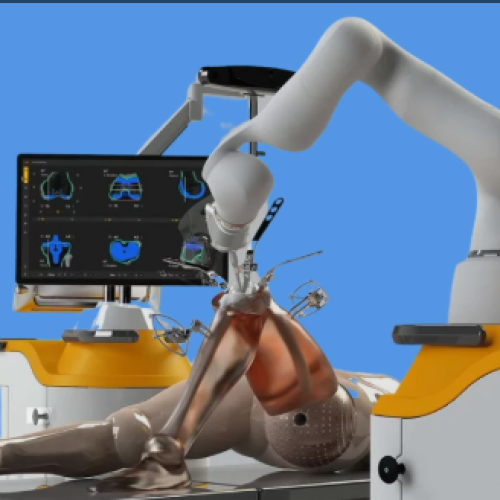 robotic knee replacement surgery in Mumbai