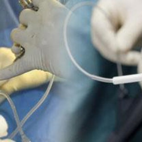 pcnl surgery in ludhiana