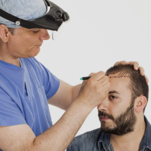 Best hair transplant in chandigarh
