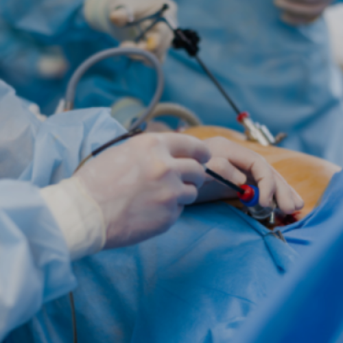 Laparoscopic Surgery in Mumbai