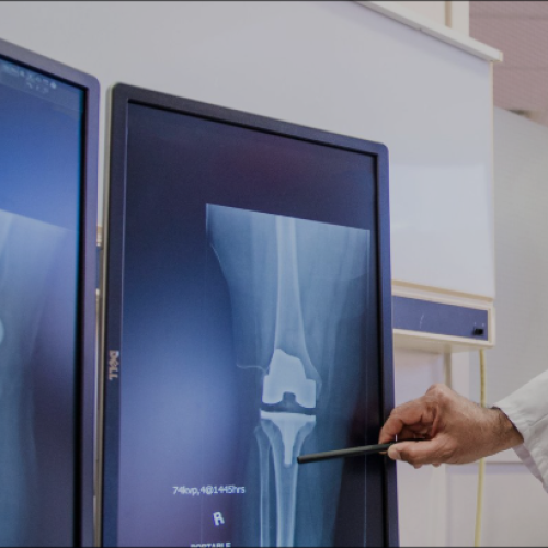 Top Knee Replacement Surgeon Chandigarh for Advanced Orthopedic Care