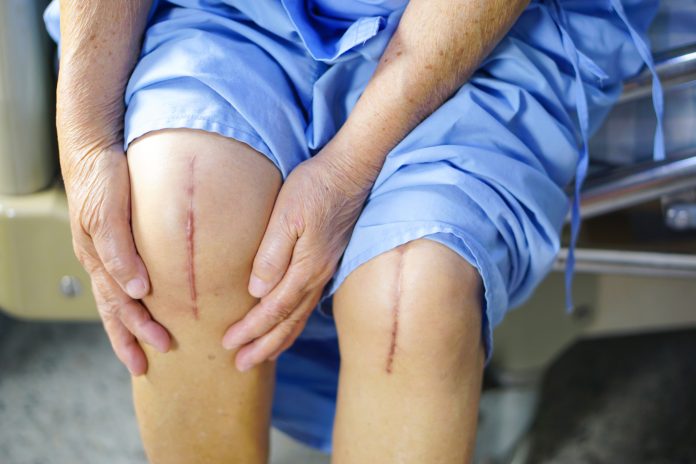 Total Knee Replacement In Chandigarh