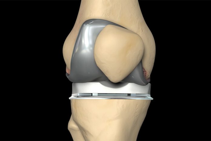 ft 3d knee resurfacing cost in India