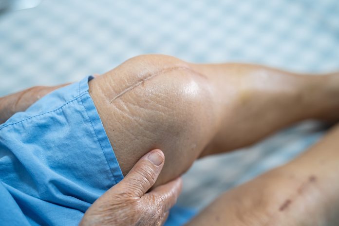 Knee replacement surgery in indore