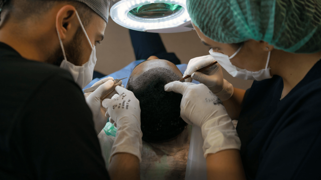 best hair transplant in Chandigarh cost