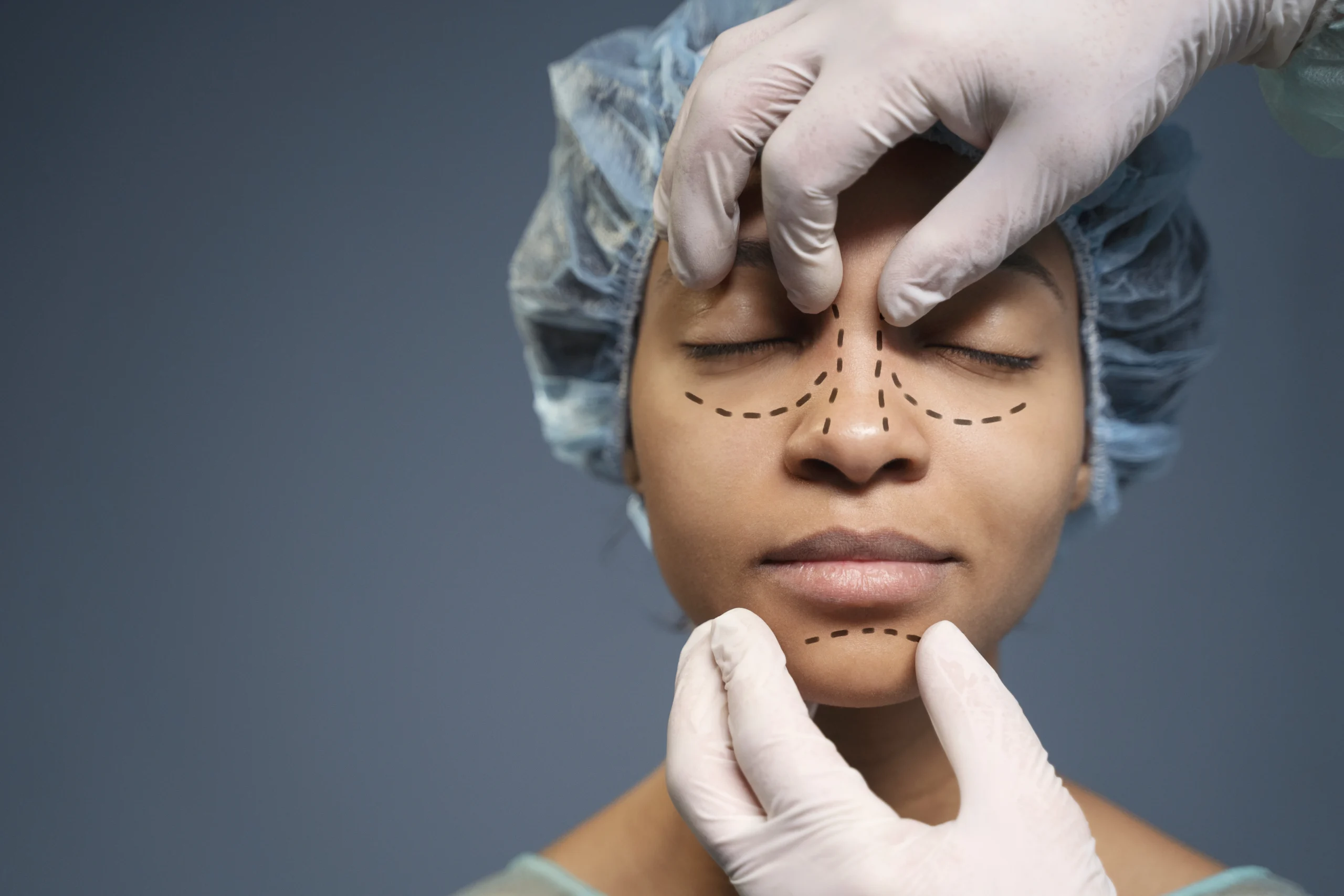 Rhinoplasty in Chandigarh: What to Expect from Your Nose Surgery Journey