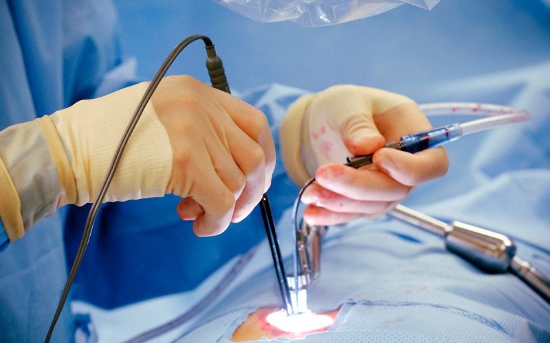 Laser Piles Surgery in Mohali