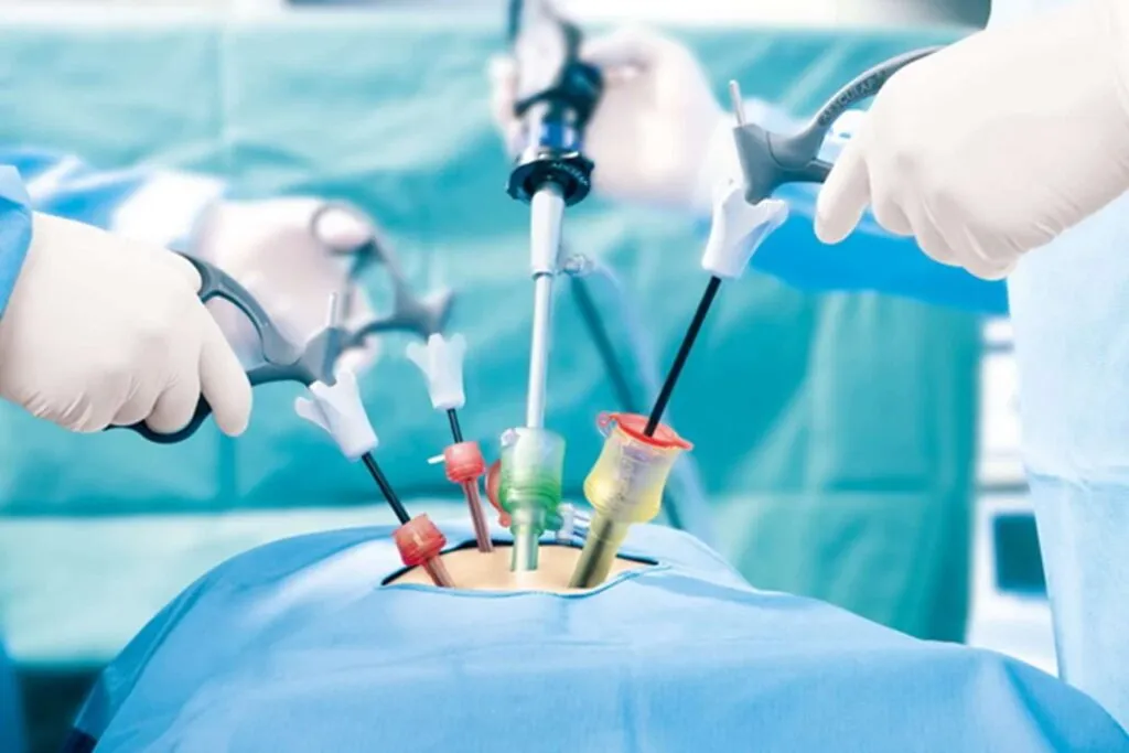 Experience Precision & Faster Recovery with Laparoscopic Surgery in Mohali