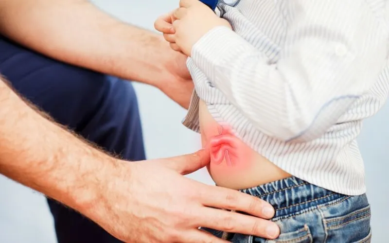 hernia surgery in Chandigarh