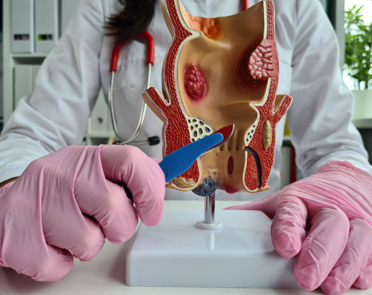 piles treatment in Chandigarh