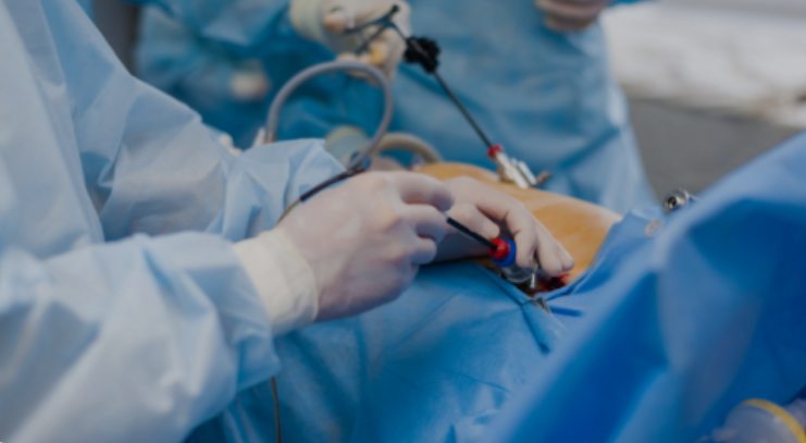 Expert Care, Modern Techniques – Discover Laparoscopic Surgery in Mumbai