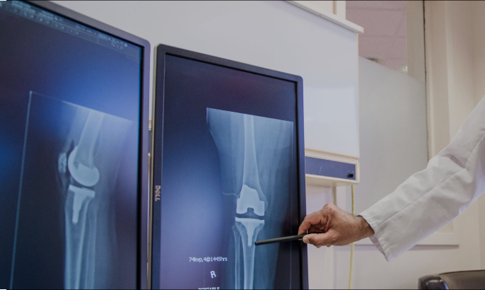 Top Knee Replacement Surgeon Chandigarh for Advanced Orthopedic Care