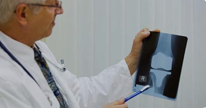 Best Knee Replacement Doctor in Mohali – Expert Care and Advanced Treatment