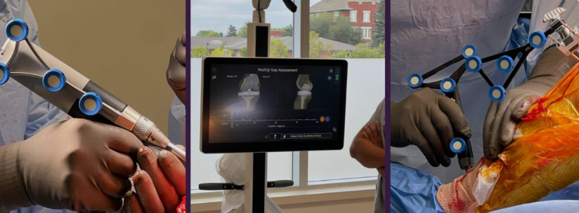 Best Robotic Knee Surgeon Chandigarh